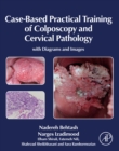 Case-Based Practical Training of Colposcopy and Cervical Pathology : With Diagrams and Images - eBook