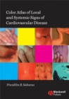 Color Atlas of Local and Systemic Manifestations of Cardiovascular Disease - eBook