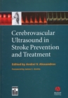 Cerebrovascular Ultrasound in Stroke Prevention and Treatment - eBook