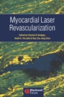 Myocardial Laser Revascularization - eBook