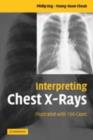Interpreting Chest X-Rays : Illustrated with 100 Cases - eBook