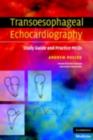 Transoesophageal Echocardiography : Study Guide and Practice MCQs - eBook