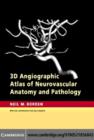 3D Angiographic Atlas of Neurovascular Anatomy and Pathology - eBook