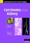 Carcinoma of the Kidney - eBook