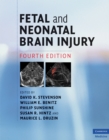 Fetal and Neonatal Brain Injury - eBook