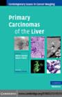 Primary Carcinomas of the Liver - eBook