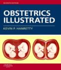 Obstetrics Illustrated E-Book : Obstetrics Illustrated E-Book - eBook