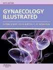 Gynaecology Illustrated E-Book : Gynaecology Illustrated E-Book - eBook