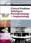 Clinical Problem Solving in Periodontology and Implantology - E-Book - eBook