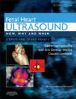 Fetal Heart Ultrasound - E-Book : Fetal Heart Ultrasound - E-Book - eBook