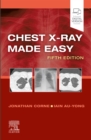 Chest X-Ray Made Easy E-Book : Chest X-Ray Made Easy E-Book - eBook