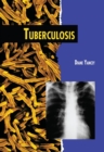 Tuberculosis (Revised Edition) - eBook