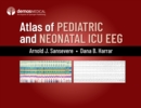 Atlas of Pediatric and Neonatal ICU EEG - eBook