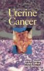 Uterine Cancer - eBook