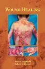 Wound Healing - eBook