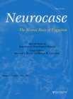 Emotions in Neurological Disease : A Special Issue of Neurocase - eBook