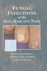Fungal Infections of the Skin and Nails - eBook