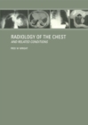Radiology of the Chest and Related Conditions - eBook