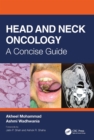 Head and Neck Oncology : A Concise Guide - eBook