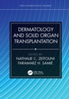 Dermatology and Solid Organ Transplantation - eBook