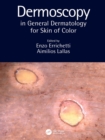 Dermoscopy in General Dermatology for Skin of Color - eBook