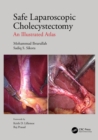 Safe Laparoscopic Cholecystectomy : An Illustrated Atlas - eBook