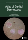Atlas of Genital Dermoscopy - eBook
