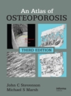 An Atlas of Osteoporosis - eBook