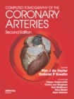Computed Tomography of the Coronary Arteries - eBook