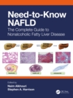 Need-to-Know NAFLD : The Complete Guide to Nonalcoholic Fatty Liver Disease - eBook