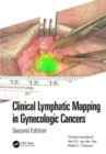 Clinical Lymphatic Mapping in Gynecologic Cancers - Book