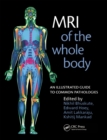MRI of the Whole Body : An Illustrated Guide for Common Pathologies - eBook