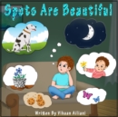 Spots Are Beautiful - eBook