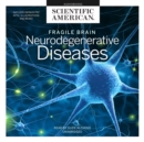 Fragile Brain - eAudiobook