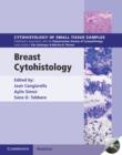 Breast Cytohistology - eBook