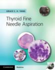 Thyroid Fine Needle Aspiration - eBook