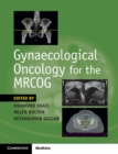 Gynaecological Oncology for the MRCOG - eBook