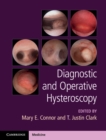 Diagnostic and Operative Hysteroscopy - eBook