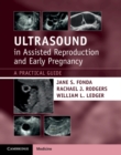 Ultrasound in Assisted Reproduction and Early Pregnancy : A Practical Guide - eBook