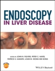 Endoscopy in Liver Disease - eBook