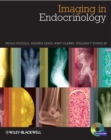 Imaging in Endocrinology - eBook