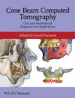 Cone Beam Computed Tomography : Oral and Maxillofacial Diagnosis and Applications - eBook