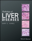 Pathology of Liver Diseases - eBook