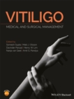 Vitiligo : Medical and Surgical Management - eBook