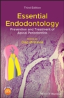 Essential Endodontology : Prevention and Treatment of Apical Periodontitis - Book