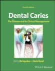 Dental Caries : The Disease and its Clinical Management - eBook