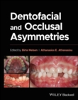 Dentofacial and Occlusal Asymmetries - eBook