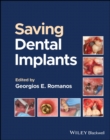 Saving Dental Implants - Book