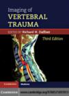 Imaging of Vertebral Trauma - eBook