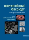 Interventional Oncology : Principles and Practice - eBook